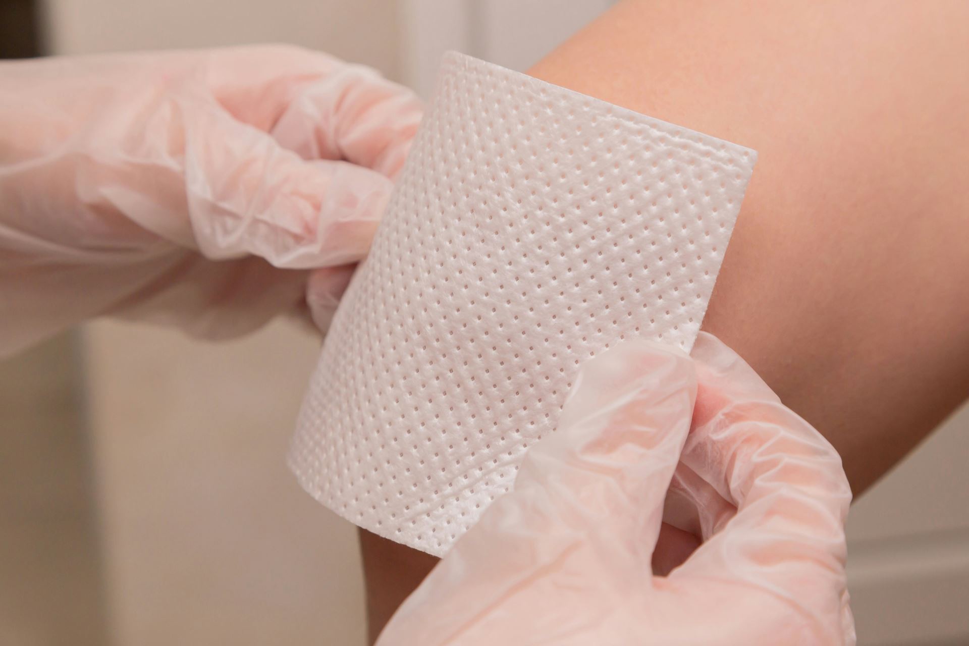 wound dressing