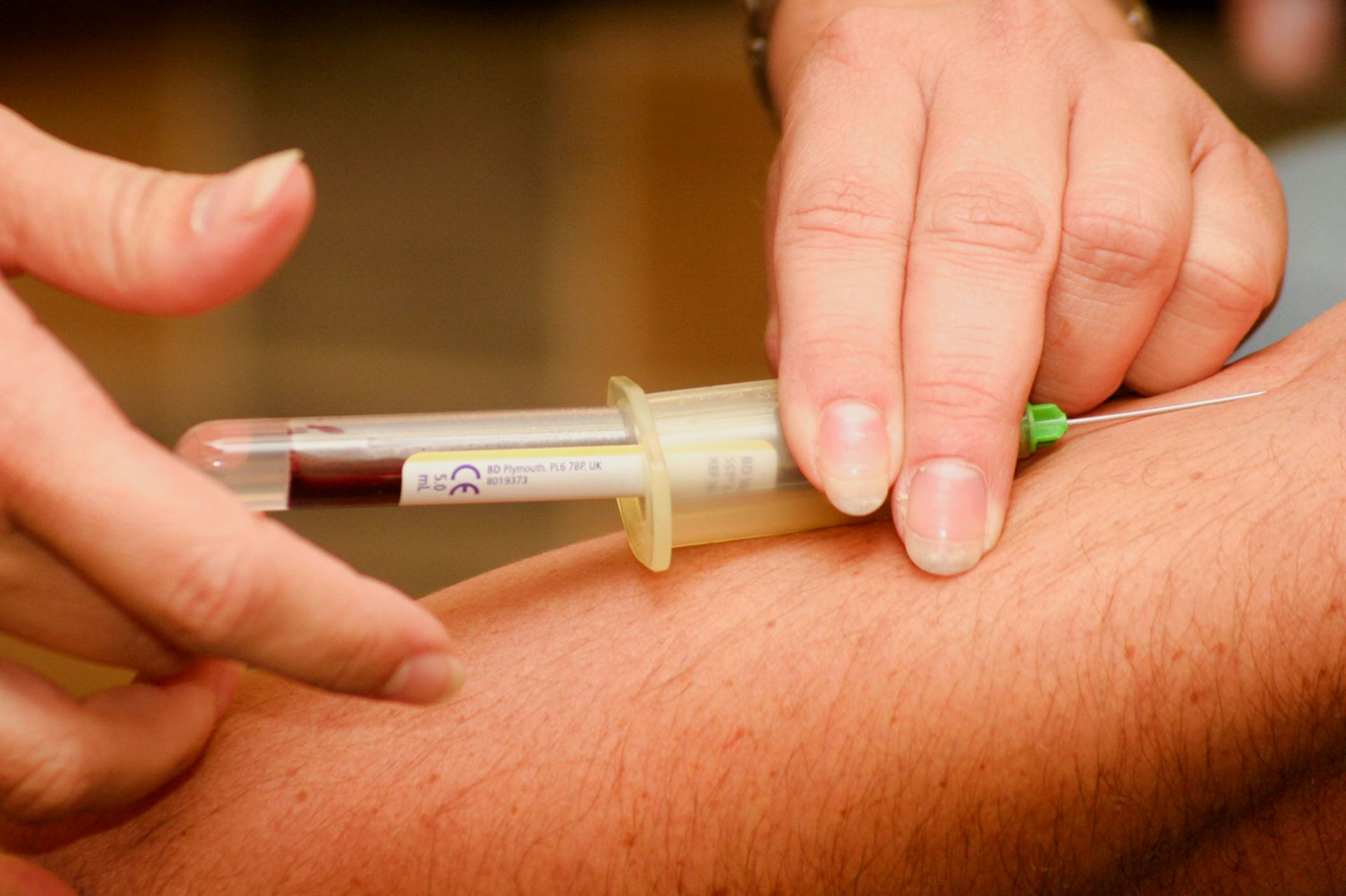 Blood withdrawal